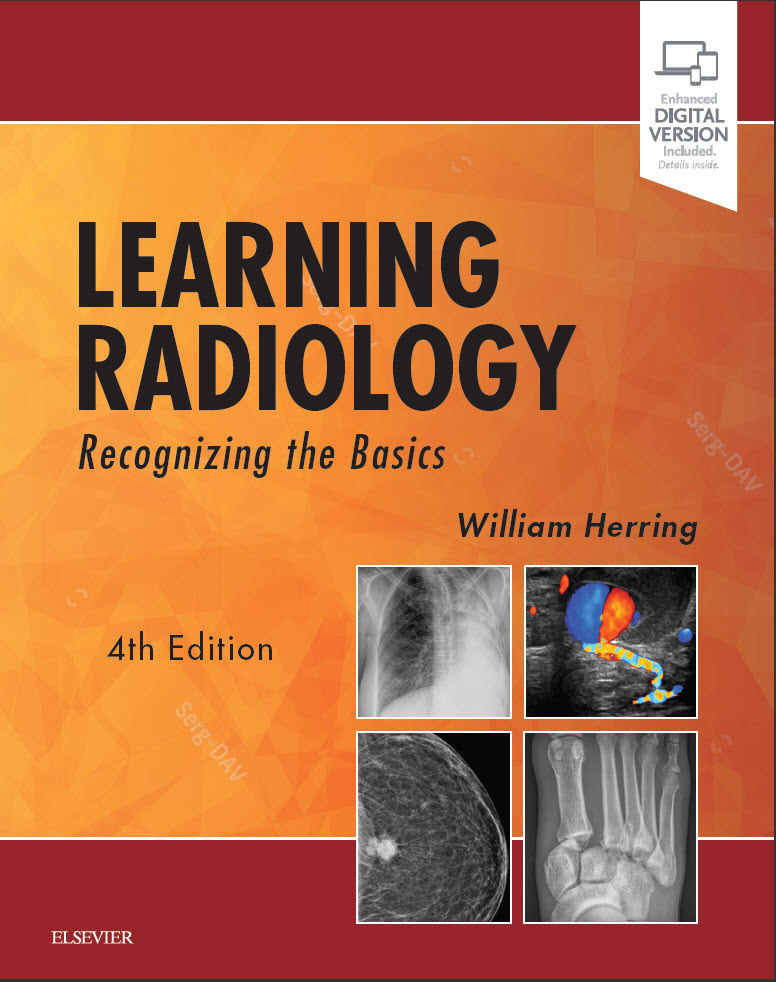 Learning Radiology 4e